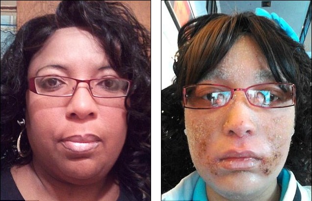 美女子全身不長毛發長指甲 屬世界首例醫學界尚無解