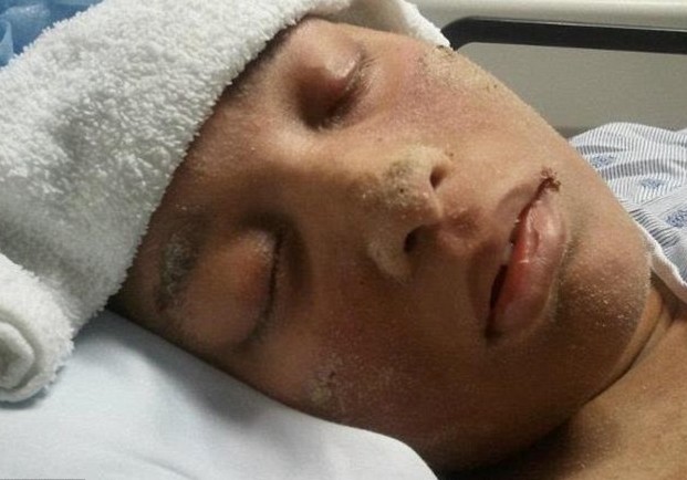 美女子全身不長毛發長指甲 屬世界首例醫學界尚無解