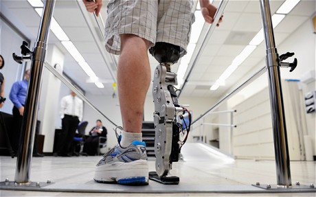 美國(guó)男子用意念控制仿生假肢 欲挑戰(zhàn)103層大廈