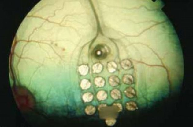新技術讓盲人“看見”文字 有望造福眾多失明者