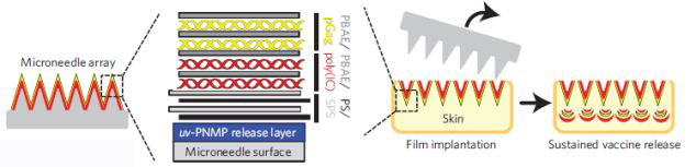美專家研制“微針”設(shè)備 有望開啟無痛注射時代