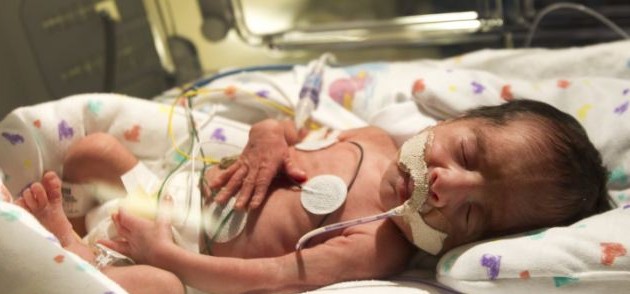 美國(guó)母親情人節(jié)生出兩組同卵雙胞胎 自然受孕率僅7000萬(wàn)分之一