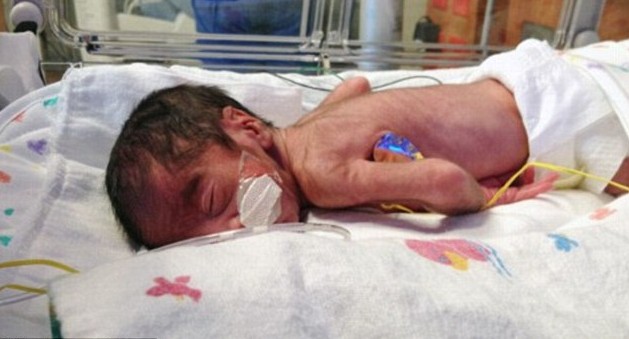 美國母親情人節生出兩組同卵雙胞胎 自然受孕率僅7000萬分之一