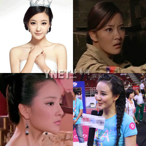 明星整容慘面癱 大S李小璐越發詭異