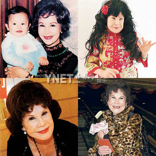 明星整容慘面癱 大S李小璐越發詭異