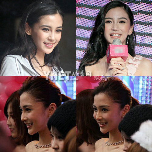 明星整容慘面癱 大S李小璐越發(fā)詭異