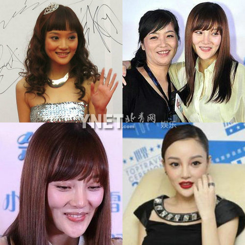 明星整容慘面癱 大S李小璐越發詭異