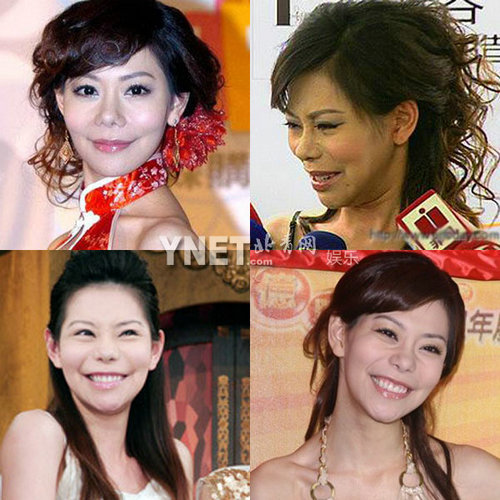 明星整容慘面癱 大S李小璐越發詭異
