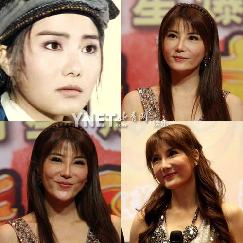 明星整容慘面癱 大S李小璐越發詭異