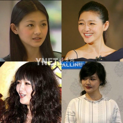 明星整容慘面癱 大S李小璐越發詭異