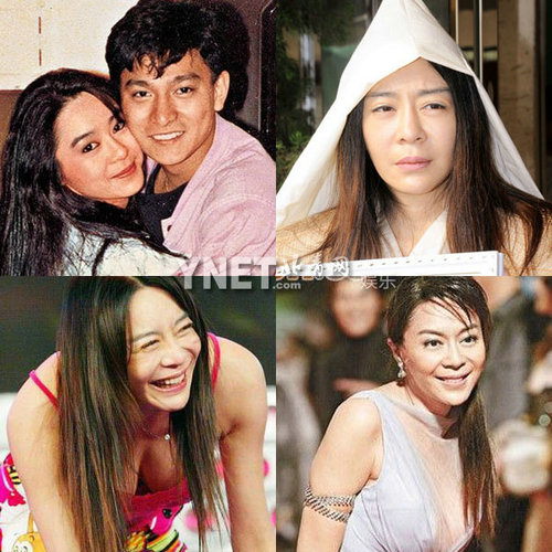 明星整容慘面癱 大S李小璐越發詭異