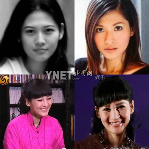 明星整容慘面癱 大S李小璐越發詭異