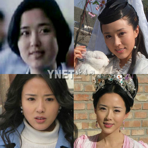 明星整容慘面癱 大S李小璐越發詭異