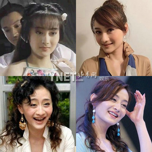 明星整容慘面癱 大S李小璐越發(fā)詭異