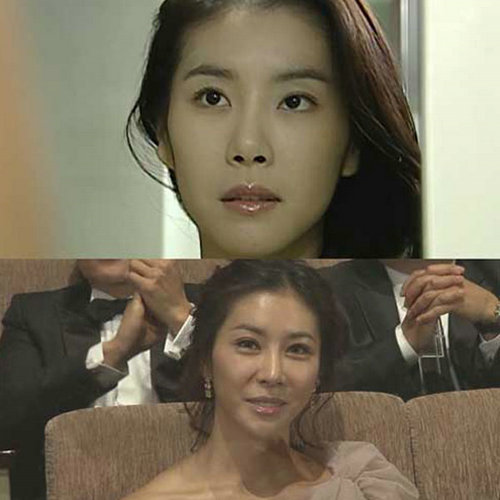 明星整容慘面癱 大S李小璐越發詭異