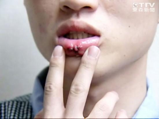 吳宗憲與三名大學生互毆 蕭亞軒柯震東成證人