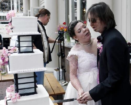 美首位“換臉人”與另一位燒傷患者喜結(jié)連理