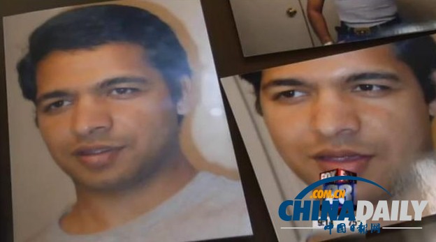 紐約帥哥歷經(jīng)22次整形手術(shù) 鼻子感染被割掉生不如死