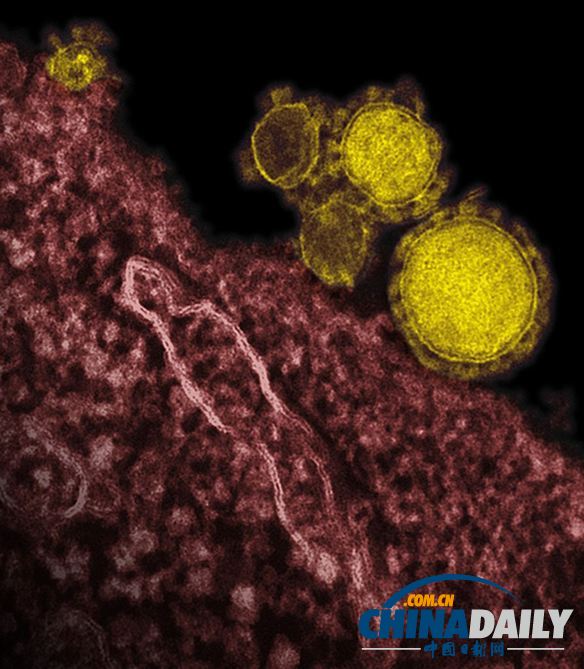 研究稱中東新冠狀病毒MERS比SARS致命率更高