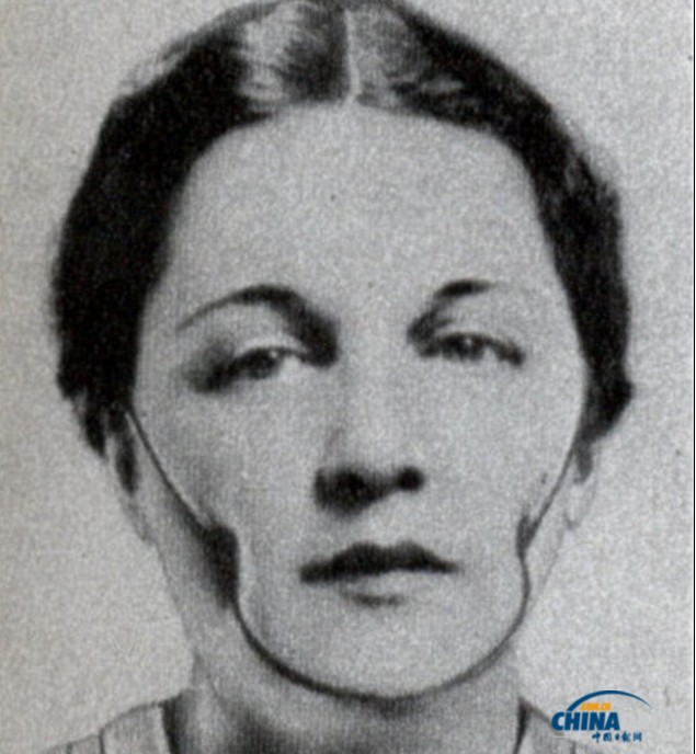 加熱美膚帽、冰凍祛斑機(jī) 圖說上世紀(jì)“恐怖”美容法