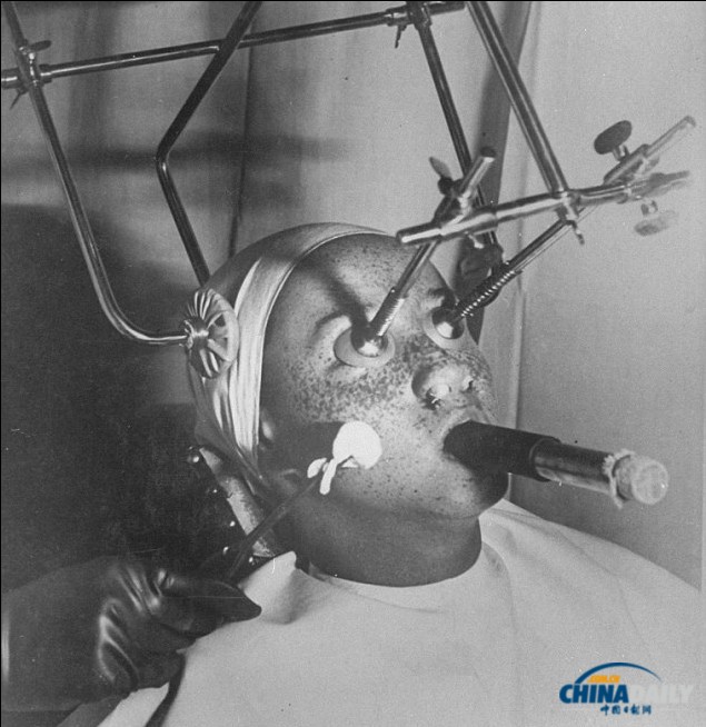 加熱美膚帽、冰凍祛斑機 圖說上世紀“恐怖”美容法