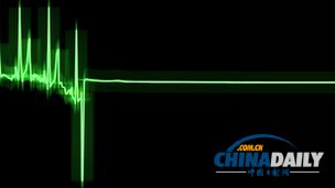 瀕死體驗有緣由:垂死之際大腦電波劇增