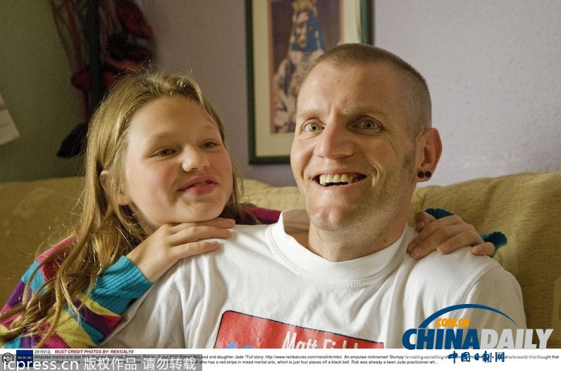 英現(xiàn)實(shí)版楊過“獨(dú)腿大俠” 首獲紅帶資格（組圖）