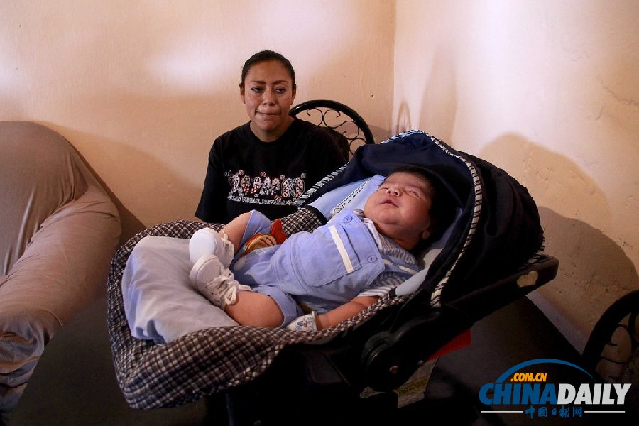 墨西哥“超級巨嬰”降生 身長62厘米重6.6公斤