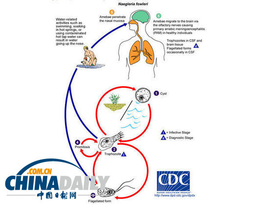 美國(guó)路易斯安那州飲用水中檢測(cè)出罕見(jiàn)“食腦蟲(chóng)”