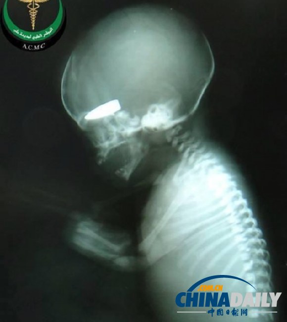 敘軍拿孕婦當游戲標靶射死胎兒獲香煙