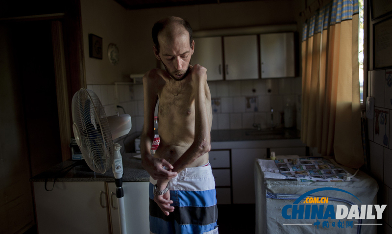 農藥遺毒深重 農業大國阿根廷付出慘痛代價