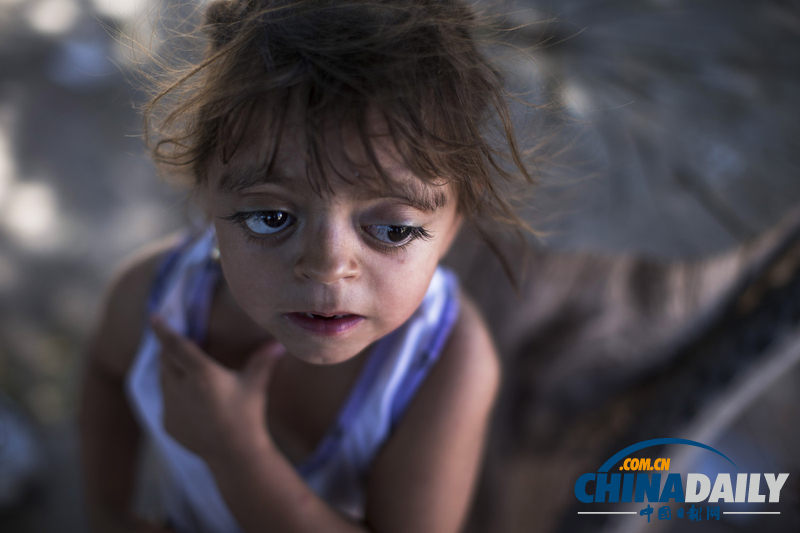 農(nóng)藥遺毒深重 農(nóng)業(yè)大國(guó)阿根廷付出慘痛代價(jià)