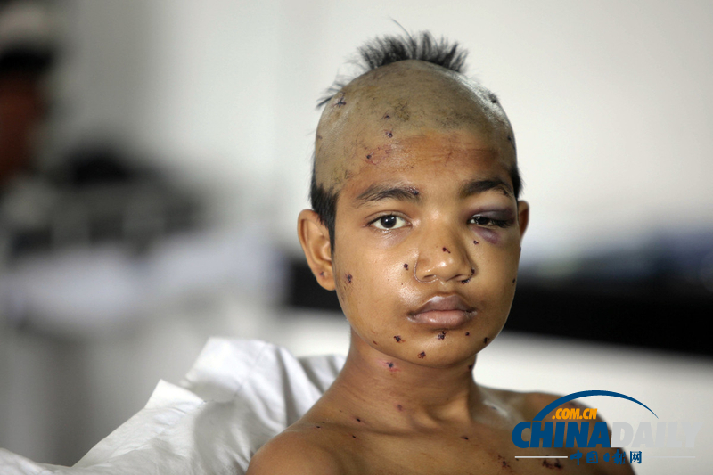 孟加拉國警方暴力驅散示威工人 多人被橡皮子彈打傷