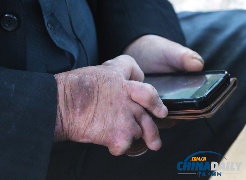 歷史遺留之痛：走近韓國小鹿島麻風病院