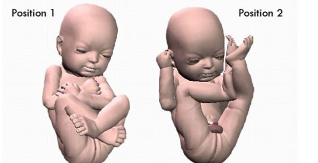 3D打印帶你見未出生胎兒!體位表情皮膚性別皆可見