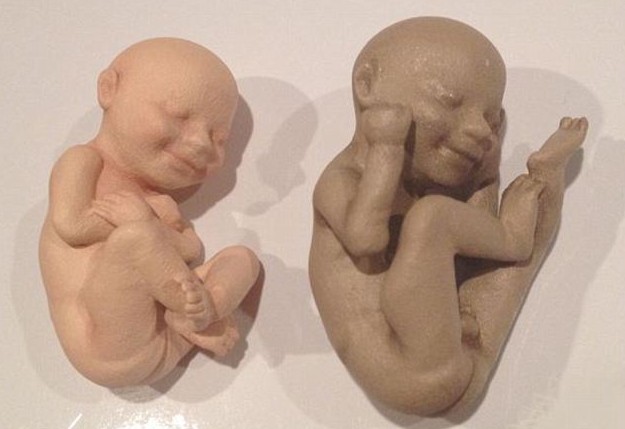 3D打印帶你見未出生胎兒!體位表情皮膚性別皆可見