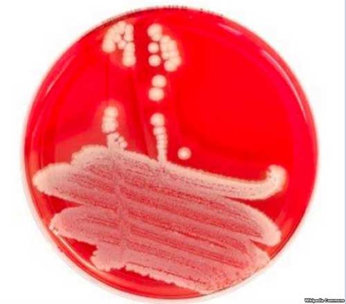 Researchers say anti-bacterial protein, PlyC could be effective antibiotic alternative Designing an alternative to antibiotics