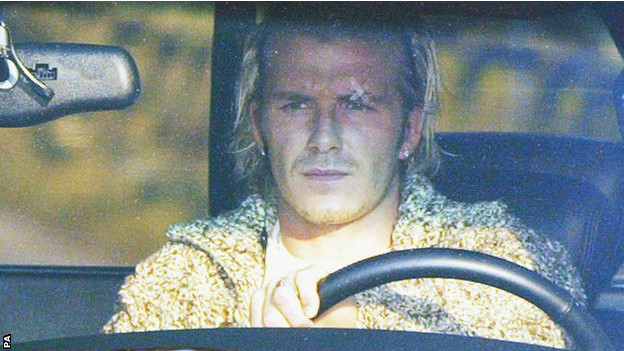 弗格森解開謎底:為什么小貝必須離開