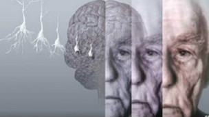 研究:鍛煉可顯著減少患癡呆癥危險