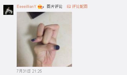 一般人做不出的張一山秋水誓？醫生：這是??！