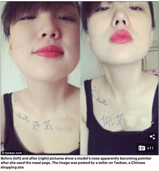 中日韓女性流行“美鼻神器” 專家警告:有生命危險