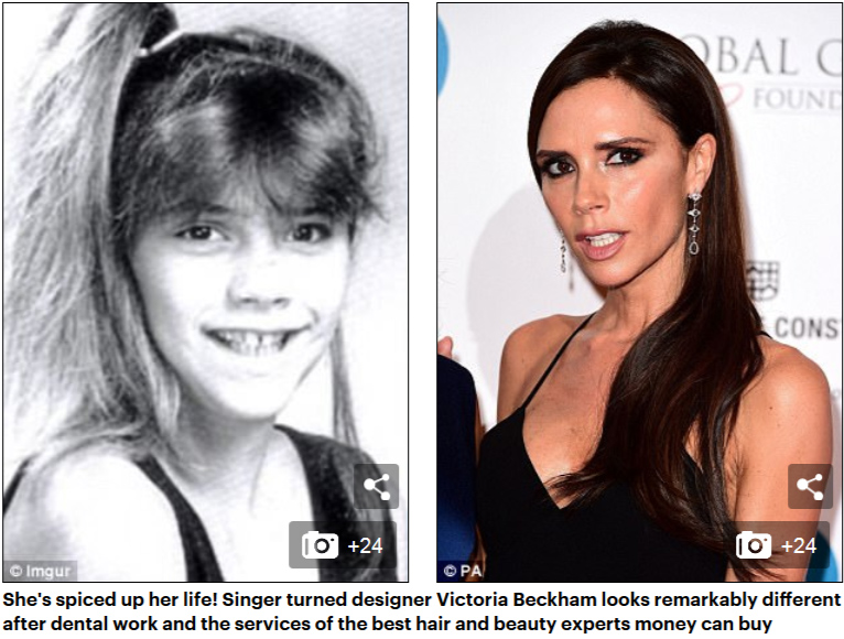 這些明星曾經也是“丑小鴨”（組圖）