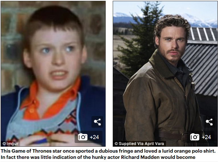 這些明星曾經也是“丑小鴨”（組圖）