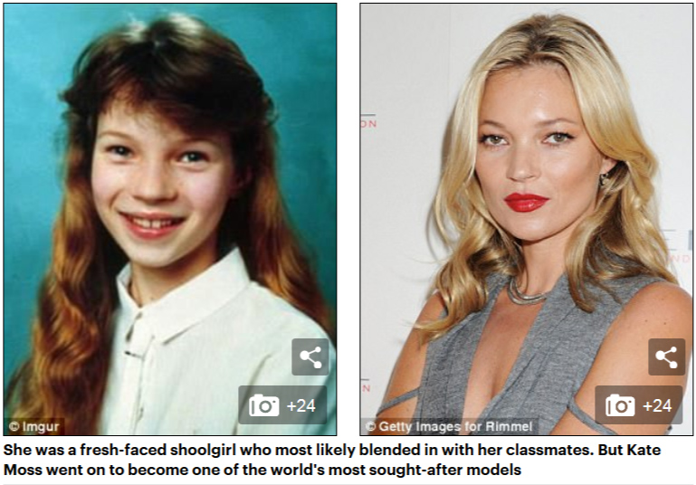 這些明星曾經也是“丑小鴨”（組圖）