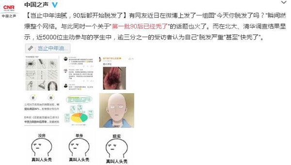 拿什么拯救90后的發際線？別急，科學家找到辦法啦