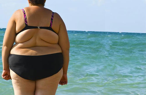 到2045年，全球1/4的人將患肥胖癥，1/8的人將患2型糖尿病