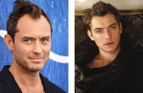 為什么男性禿頭都禿成一個樣？心疼男神們的發際線