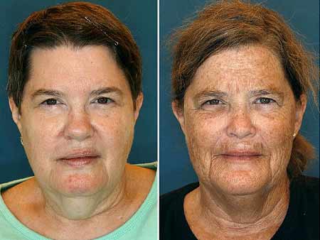 皮膚老化？生活習慣惹的禍