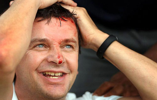 老虎伍茲開球失手 短時間內擊中球迷頭部兩次