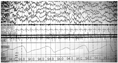 Casting dread out of dreams